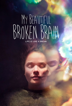 Watch Free My Beautiful Broken Brain HD Online on SFlix